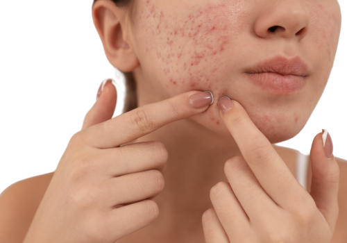 Invisalign and Orthodontic Care